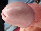 mon gland