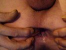 ANUS DILATE