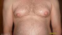 my breasts without suction