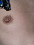 8.  Around nipple