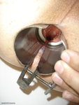 SPECULUM ANAL SUITE